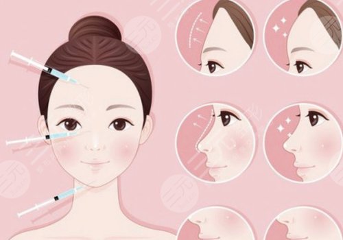 玻尿酸輪廓固定提升能保持多久呢？