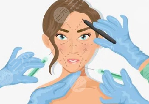 玻尿酸輪廓固定提升能保持多久呢？