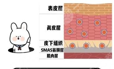 筋膜提升術(shù)