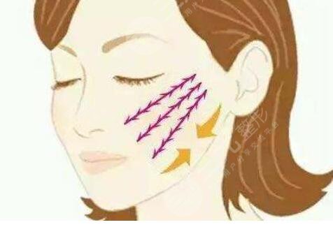 內(nèi)輪廓固定