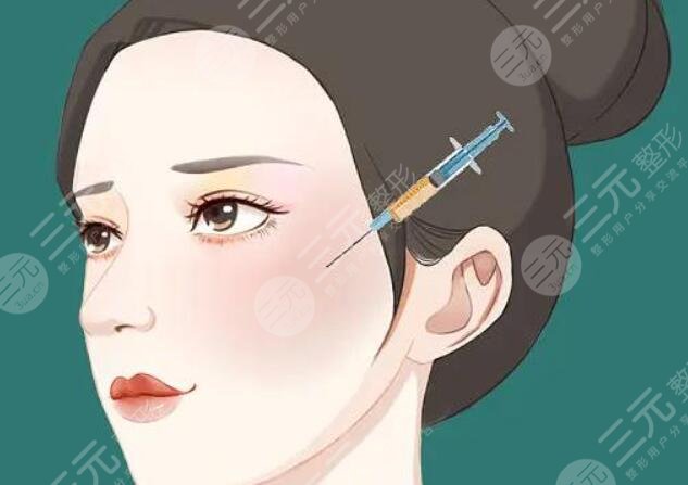 內(nèi)輪廓固定