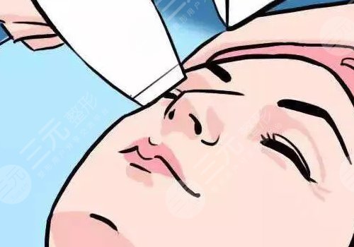 超聲炮三天后臉變方