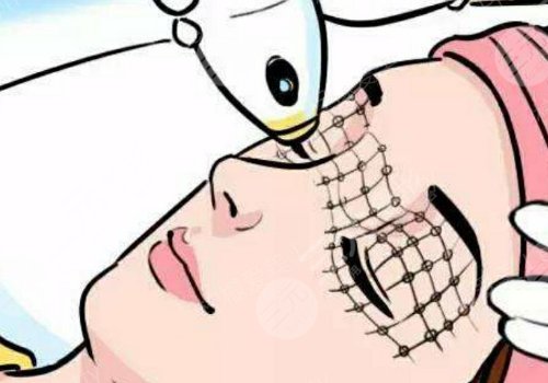 超聲炮三天后臉變方