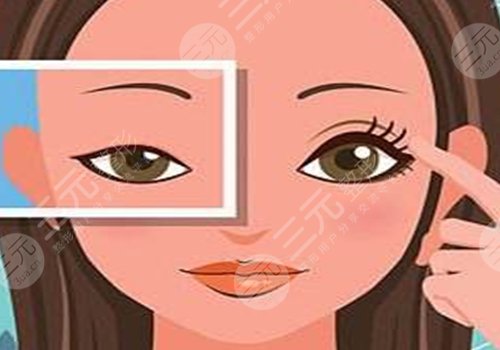 做眼部提拉手術(shù)能維持多久？