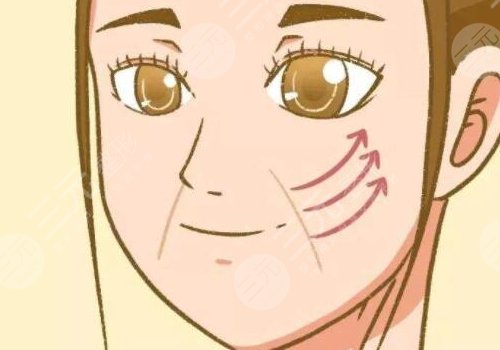 筋膜懸吊面部提升術(shù)價格