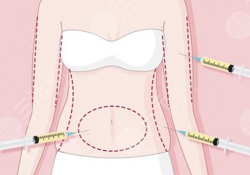 潘紅偉醫(yī)生有名嗎？