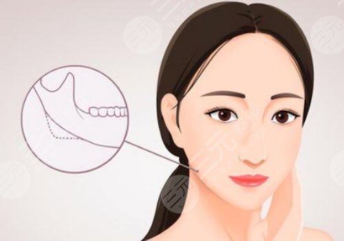 姜宇祿磨骨案例