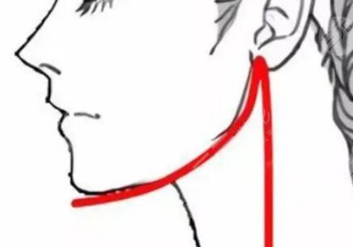 姜宇祿磨骨案例