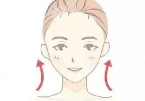 什么是筋膜懸吊面部提升術(shù)？