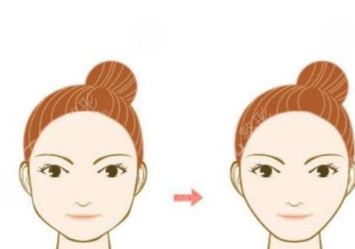 臉部輪廓固定要多少錢一次呢？氣質(zhì)臉型get攻略！