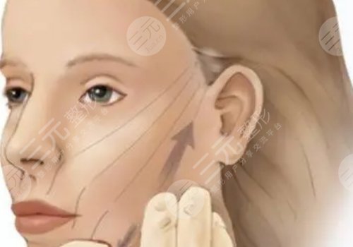 筋膜懸吊面部提升和線雕哪個好？