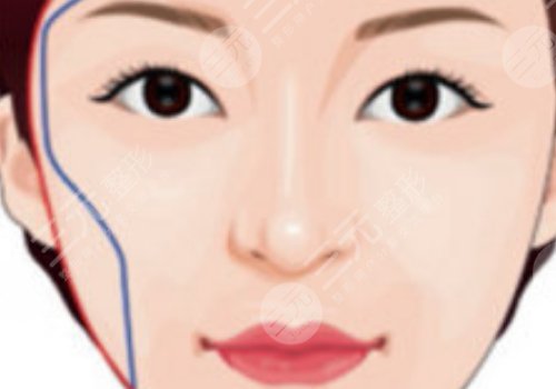 面部輪廓固定怎么做？