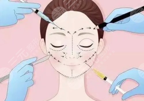 面部輪廓固定怎么做？