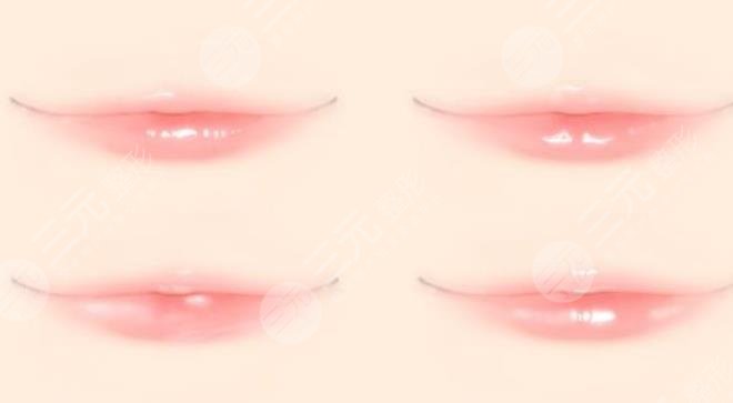 下嘴唇很不對稱