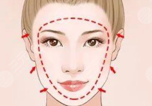 外輪廓包括哪些部位？