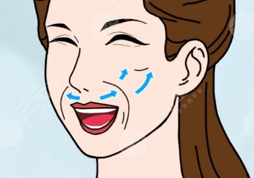 皺紋去除的好辦法是什么？