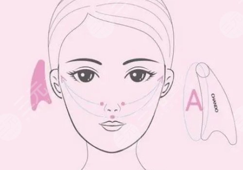 外輪廓固定怎么做多少錢