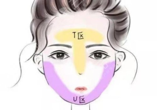 面部外輪廓固定怎么做？