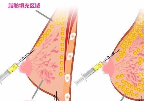 南京鼓樓醫(yī)院整形外科醫(yī)生名單