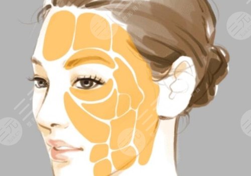 凹陷修復(fù)多少錢一個(gè)坑？