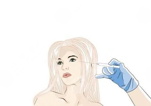 緊致提升針能保持多久？