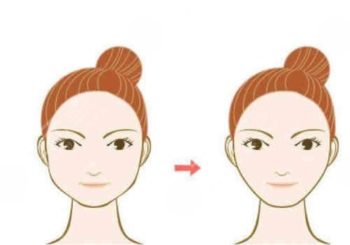 做完輪廓手術(shù)臉更大了怎么回事？
