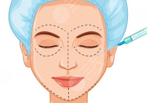 做完輪廓手術(shù)臉更大了怎么回事？