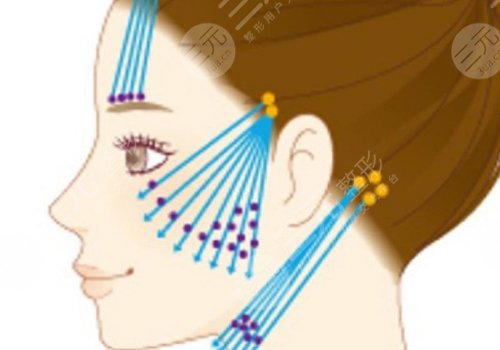 50歲做面部提升多少錢？