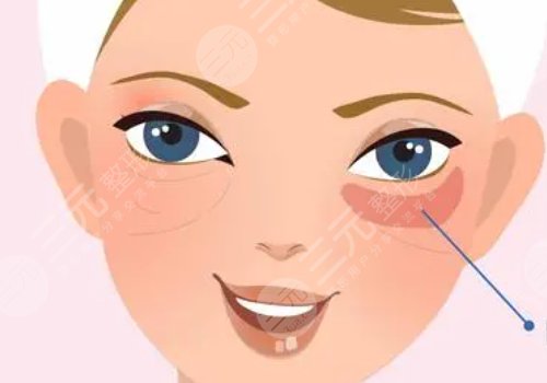 腫眼泡怎么消除？