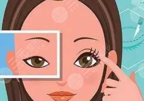 腫眼泡怎么消除？