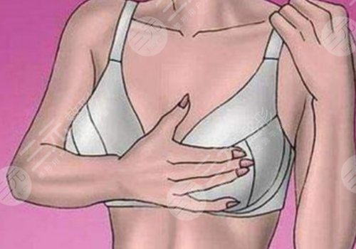 微調(diào)和整容的區(qū)別