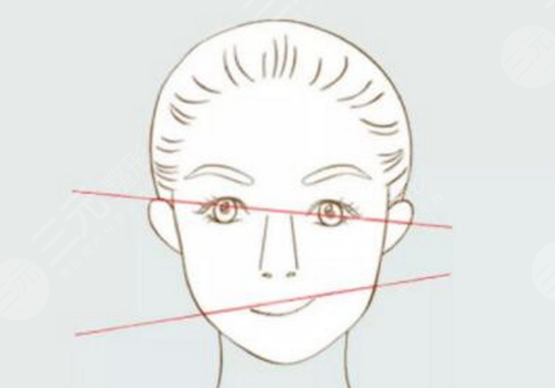 臉型歪了不對(duì)稱怎么整