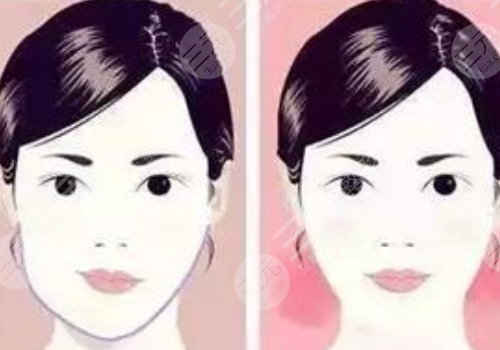 臉型歪了不對(duì)稱怎么整