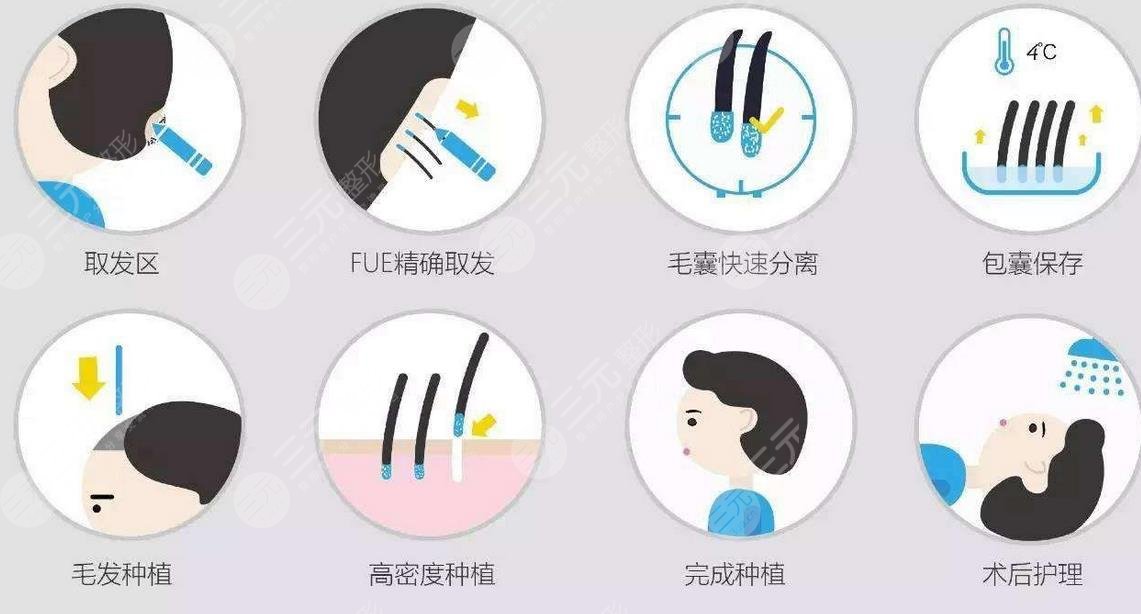 上海九院整形科植發(fā)費(fèi)用