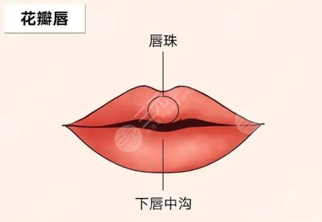 花瓣唇