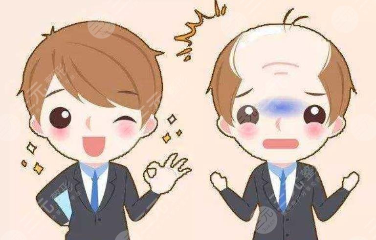 上海中山醫(yī)院植發(fā)多少錢