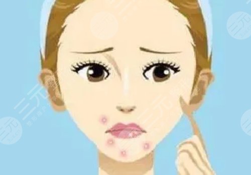 口周圍長痘痘是什么原因