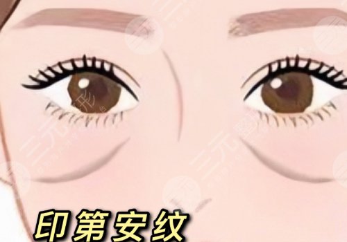 印第安紋和淚溝的區(qū)別是什么？