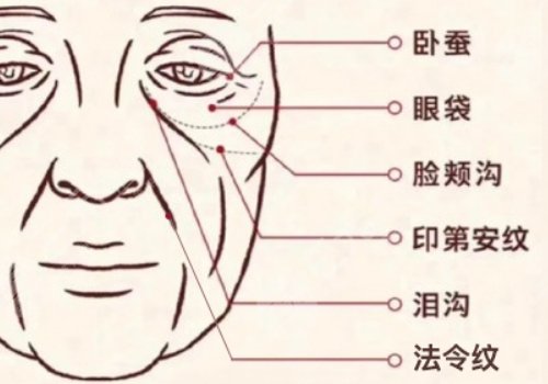 印第安紋和淚溝的區(qū)別是什么？
