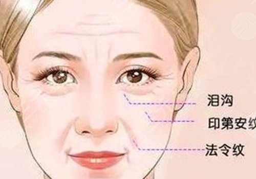 印第安紋和淚溝的區(qū)別是什么？