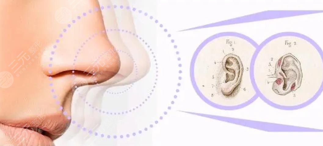 北醫(yī)三院整形科隆鼻案例