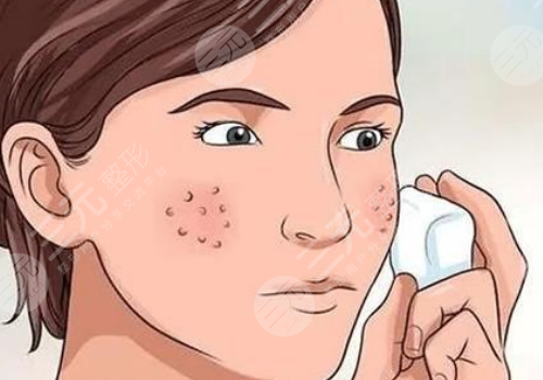 面頰毛孔粗大怎么辦？
