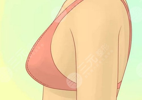 哪種胸型更好看？