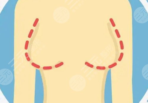 哪種胸型更好看？