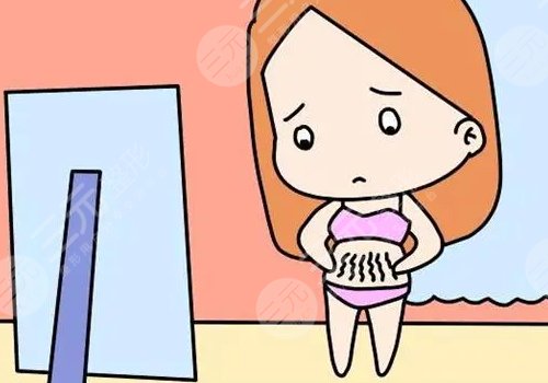 腹部拉皮手術(shù)多久能恢復正常？