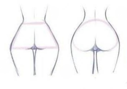 假體豐臀需要多少錢？