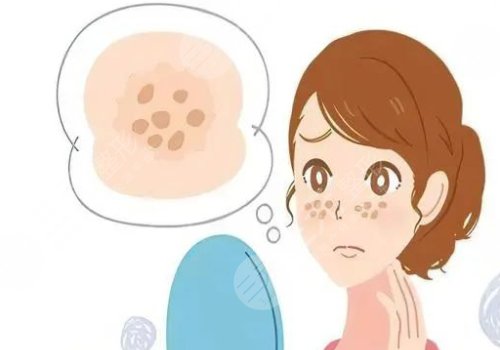 臉頰兩側(cè)長(zhǎng)斑是什么原因？