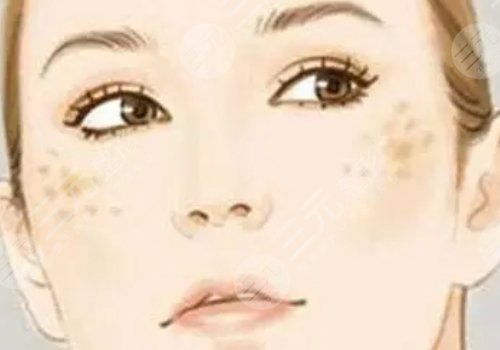 臉頰兩側(cè)長(zhǎng)斑是什么原因？