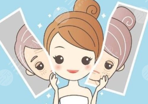 臉頰兩側(cè)長(zhǎng)斑是什么原因？