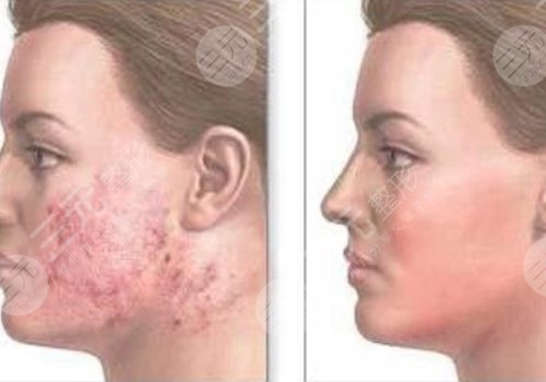 南華大學附屬第一醫(yī)院整形外科是外包嗎？